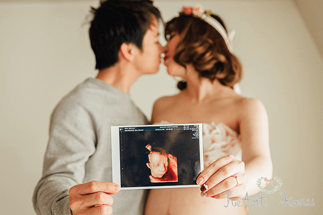 夫婦がキスをしているマタニティフォト。これから生まれてくる赤ちゃんのエコー写真が写っていてとても幸せそう。